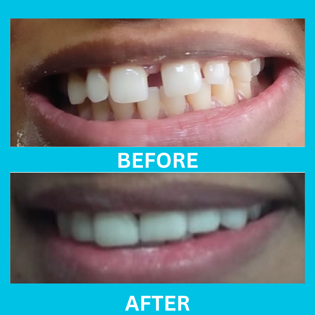 Dental Result 10