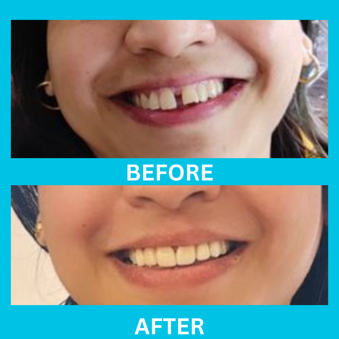 Dental Result 11