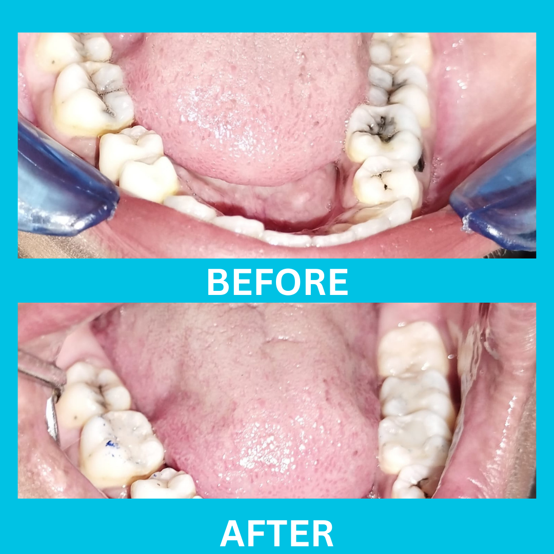 Dental Result 12