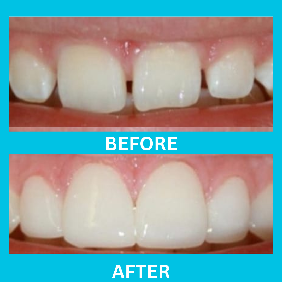 Dental Result 13