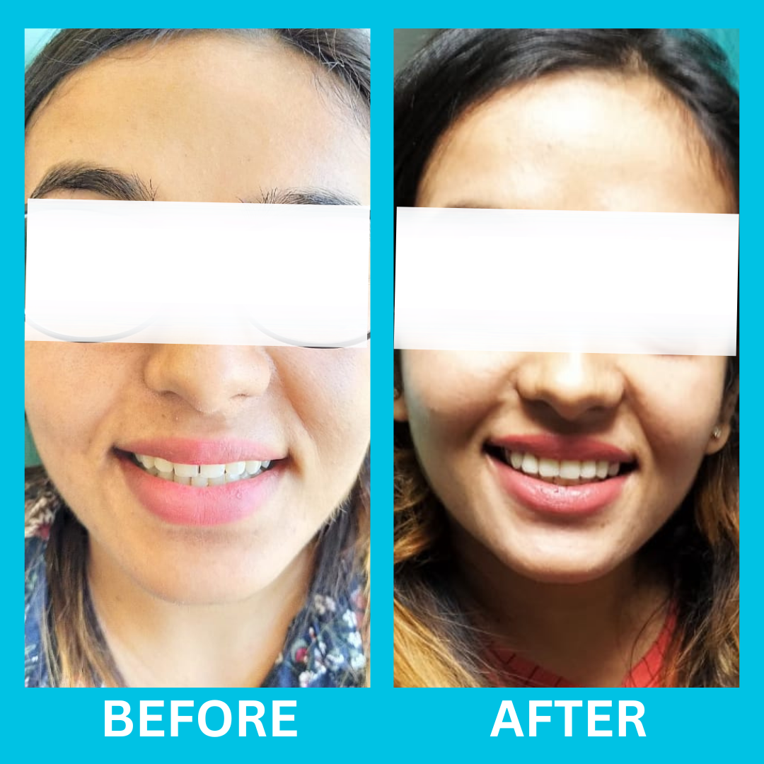 Dental Result 2