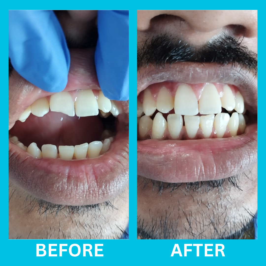 Dental Result 3