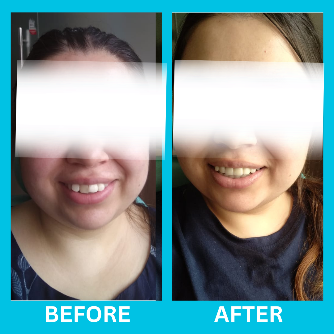 Dental Result 5