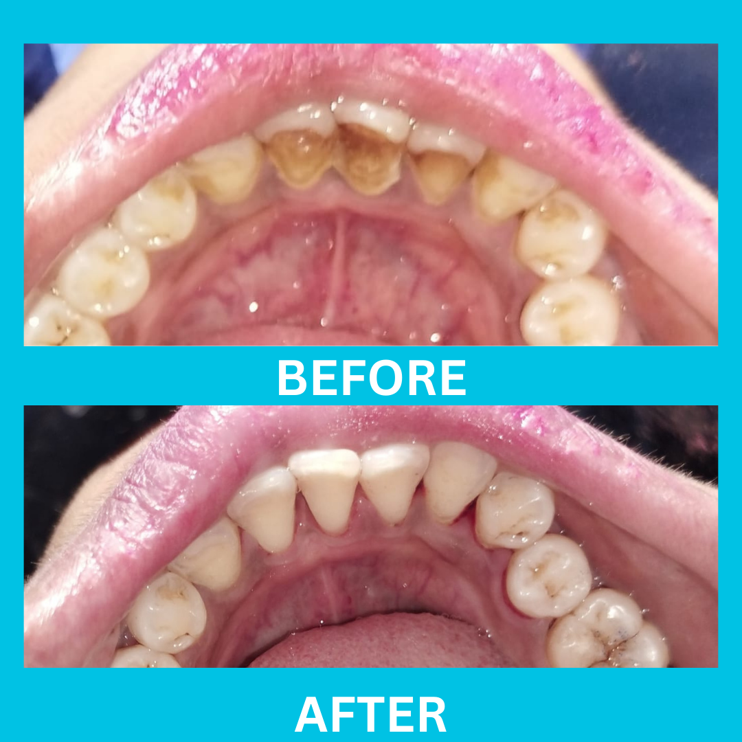 Dental Result 6