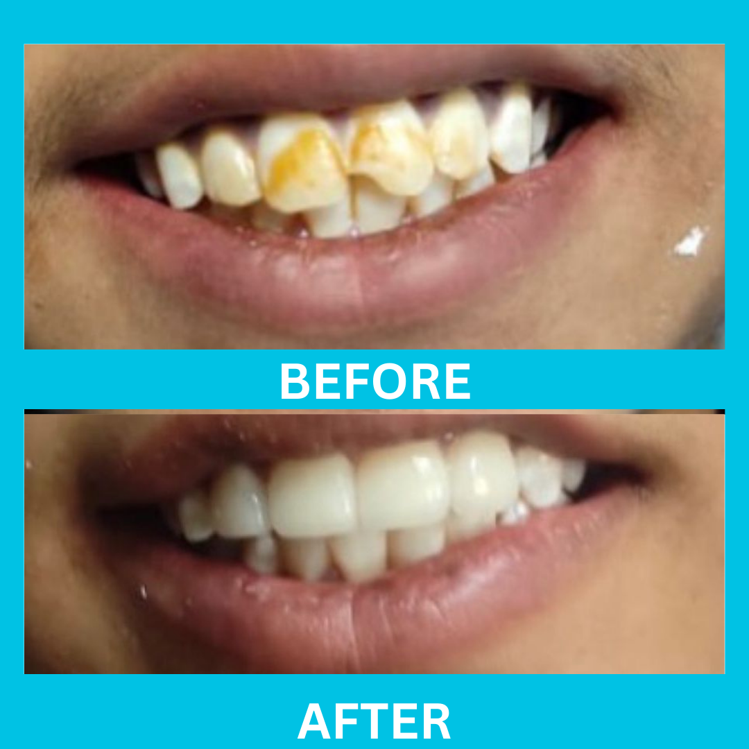 Dental Result 7