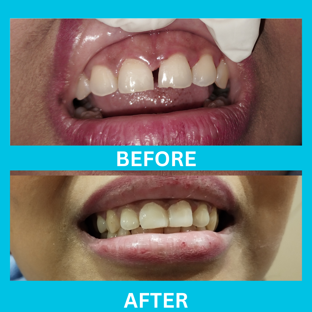 Dental Result 8