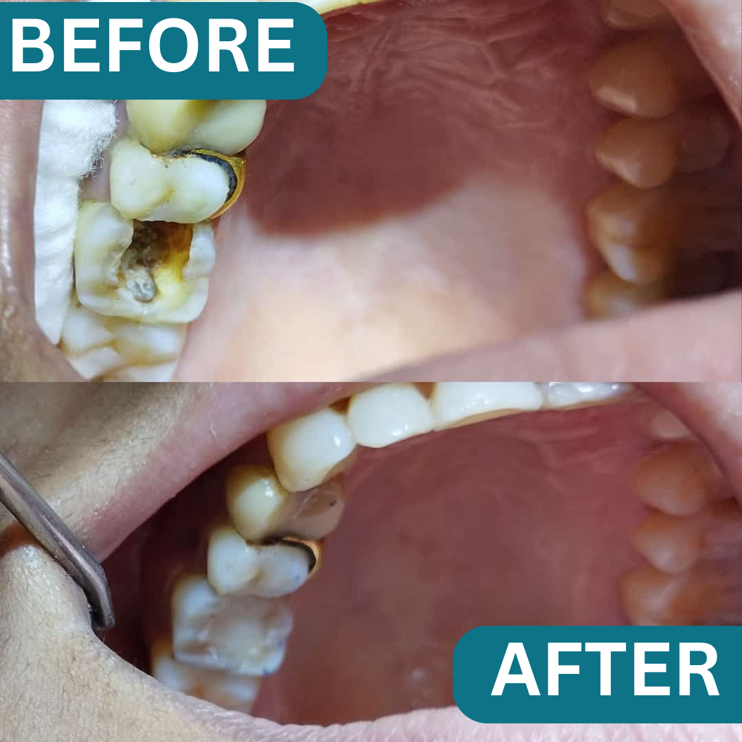 Dental Result 9