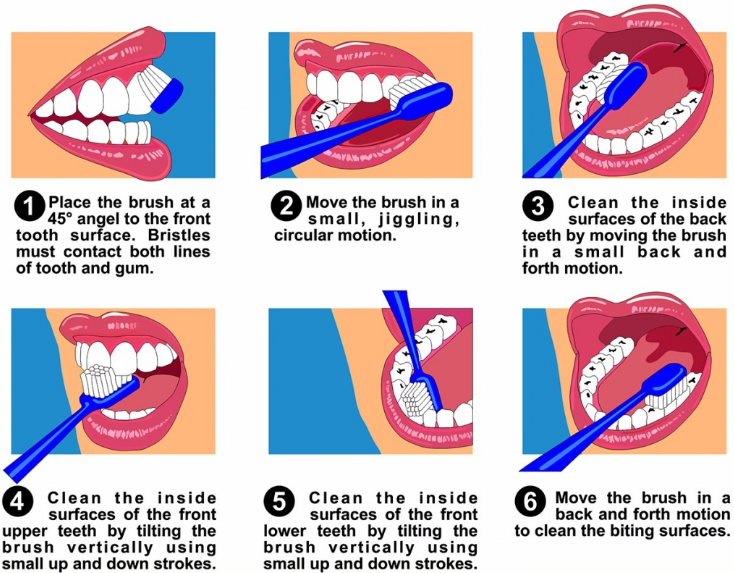 Illustrated step-by-step guide showing the correct tooth brushing technique for cleaning front, back, and biting surfaces of teeth.