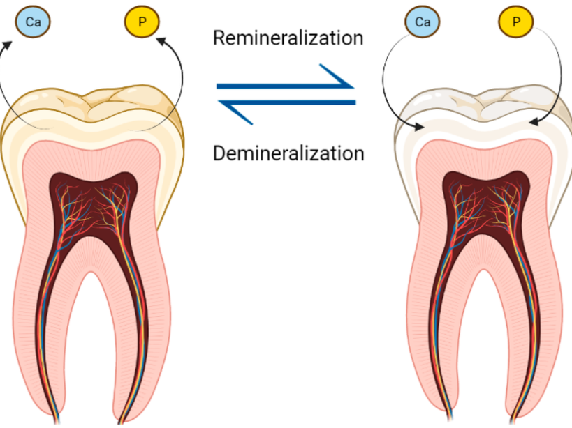 Diagram showing tooth enamel demineralization and remineralization, with calcium and phosphate minerals moving in and out of the enamel.