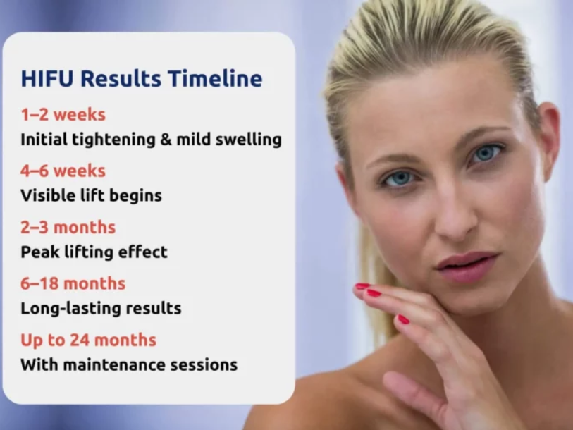 HIFU results timeline showing gradual skin tightening and lifting from 1 week to 24 months with maintenance sessions.