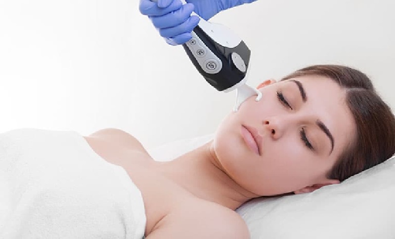 CO2 Laser Treatment Cost